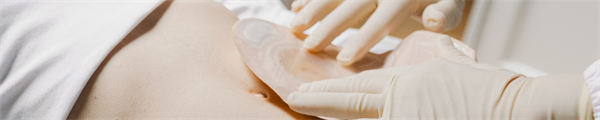 A Practice-embedded, PDSA-guided Implementation Study of Continuing Professional Development for Stoma Care in a Resource-constrained Setting